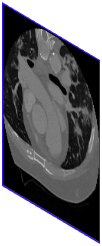 Figure 39
